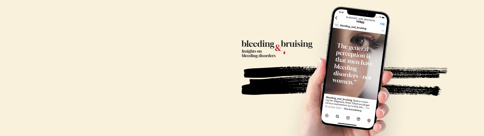 Bleeding and Bruising 