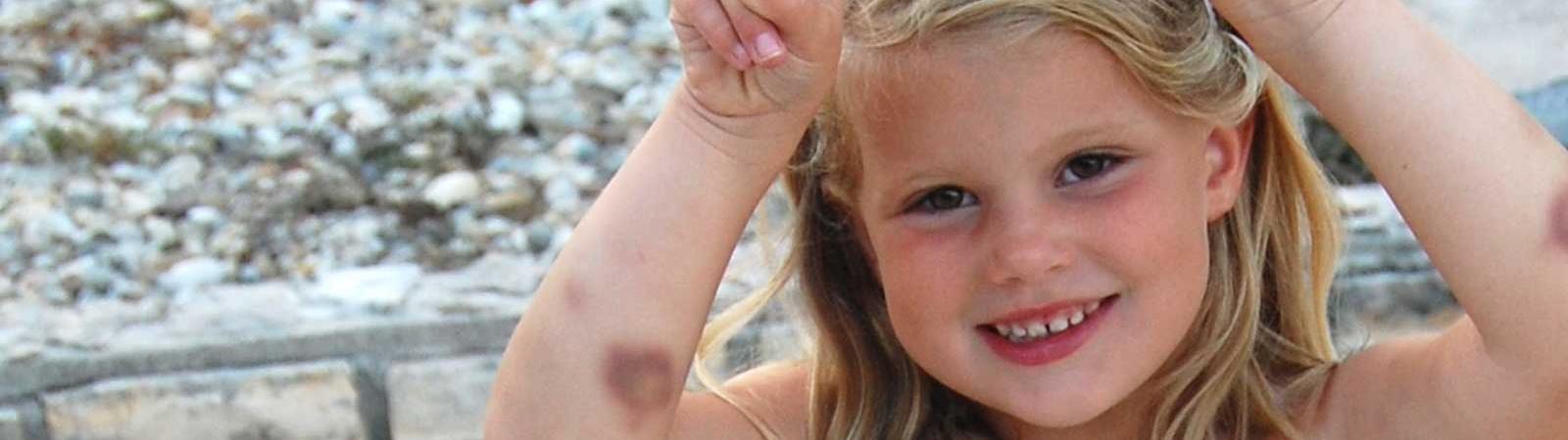 allt-om-von-Willebrands-sjukdom